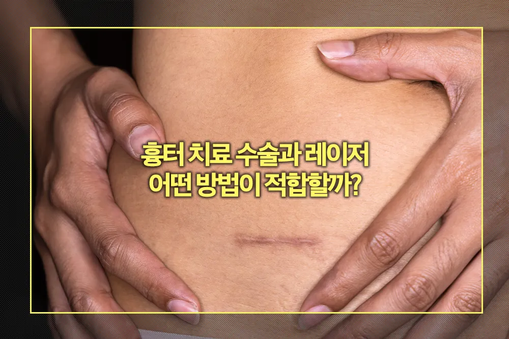 흉터 치료 수술과 레이저 선택 방법
