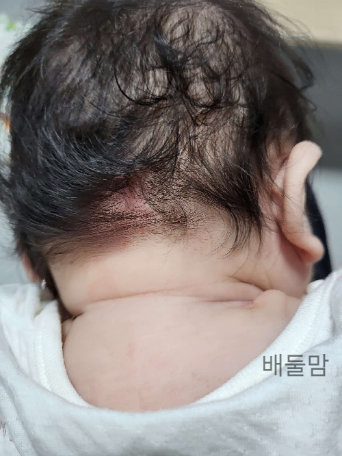 뒷통수 연어반 사진2.