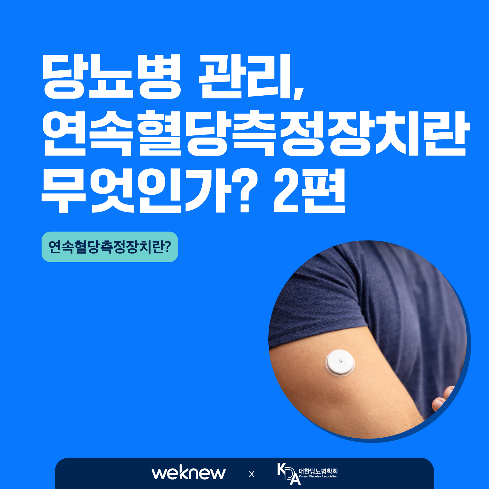 연속혈당측정기