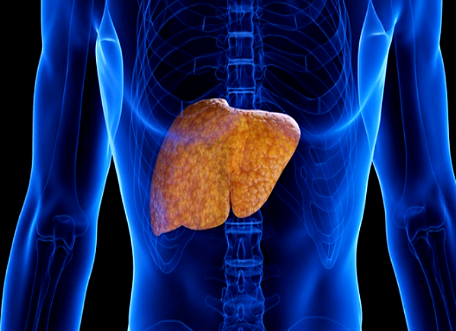 지방간 원인과 개선 방법