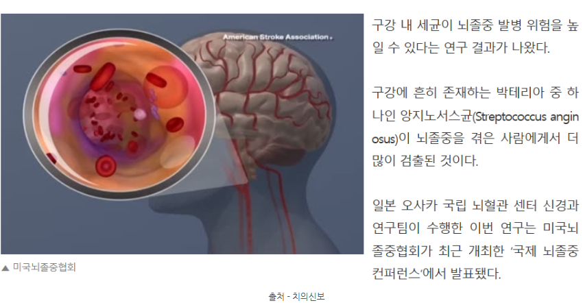 구강 건강 관리로 심혈관 질환과 치매를 예방하는 방법 관련 이미지