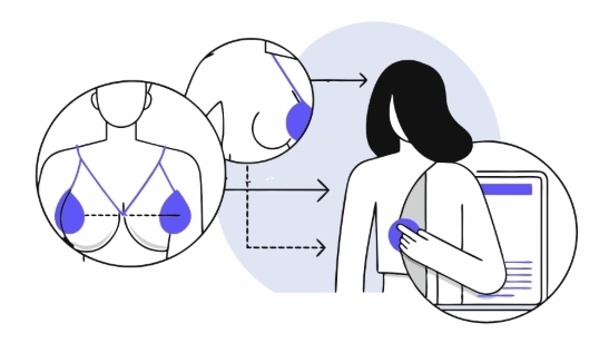 유방암2기 치료과정