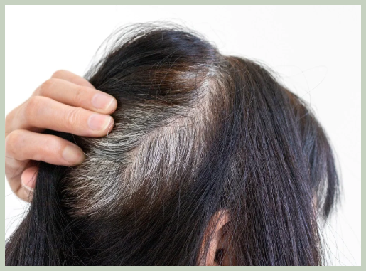 새치 나는 이유