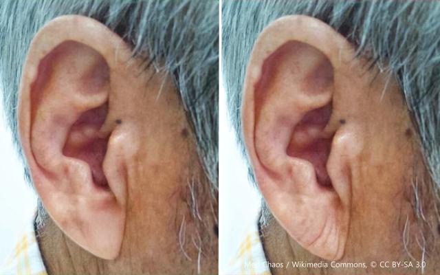 귀 건강 귓불주름 심장