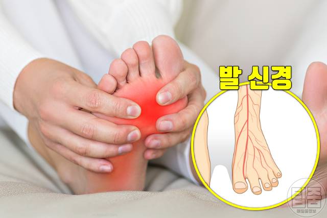 발뒤꿈치 찌릿 따끔 발바닥 전기 통증 신경종