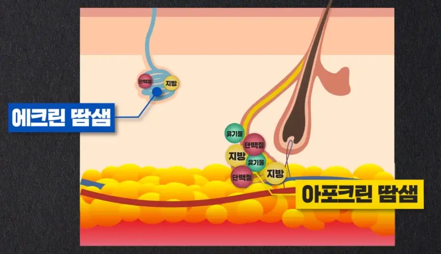 액취증의 발생 원인