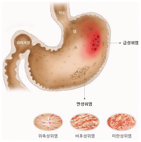 노루궁뎅이버섯의-효능