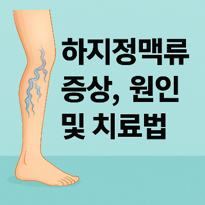 하지정맥류 증상과 치료법