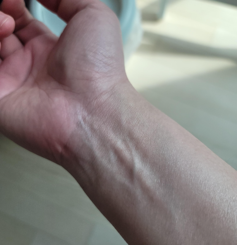 울티드볼 사용 후 손목