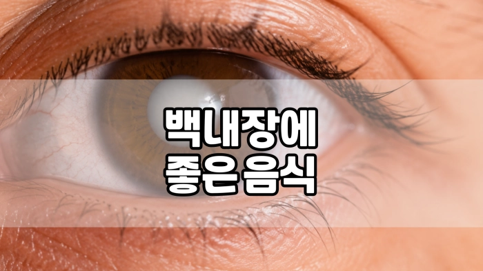 백내장에 좋은 음식