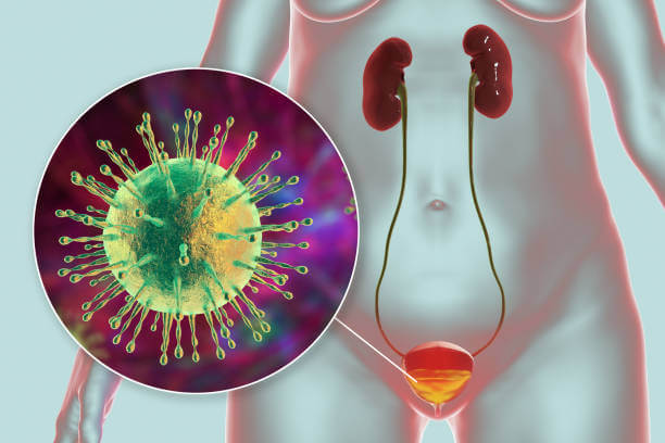 방광염 증상과 치료, 소아 방광염 증상까지 확인하시기 바랍니다. 가끔 소변을 참는 습관이 있다면 꼼꼼히 읽어 보시기 바랍니다.