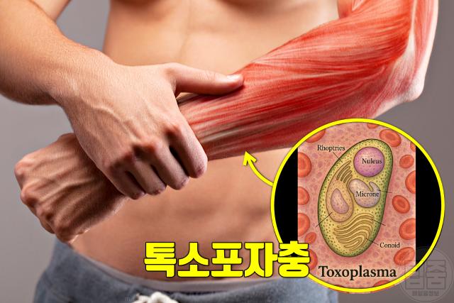 기생충 감염 증상 톡소포자충 선모충