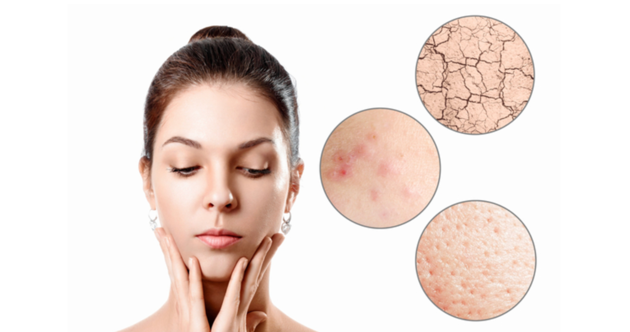 코리아 피부 미용 협동조합의 피부관리