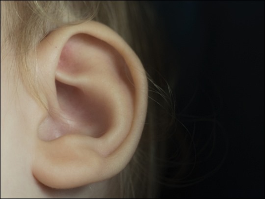 돌발성 난청 원인 3