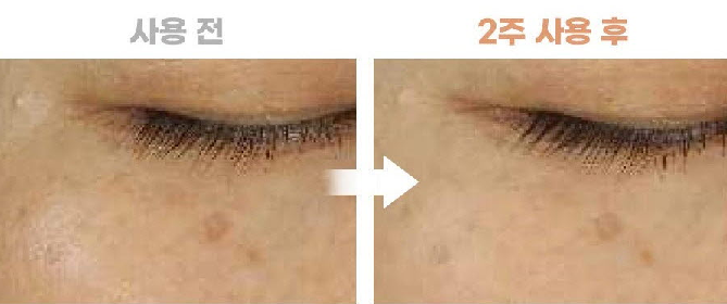 오에르 고농축 비타민c 앰플 미백 피부관리로 추천