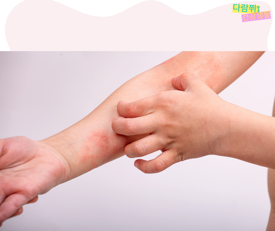 아토피를 악화시키는 생활 습관 7가지, 지금 당장 고쳐야 할 것들