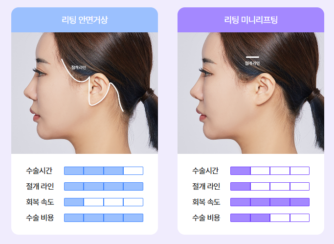 신사역안면거상 미니리프팅가격