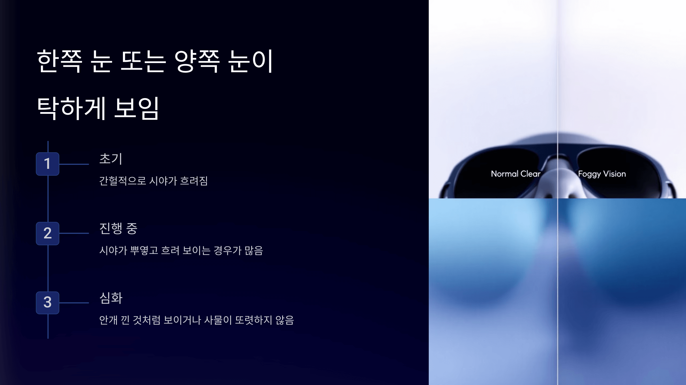 녹내장과 관련된 사진입니다.