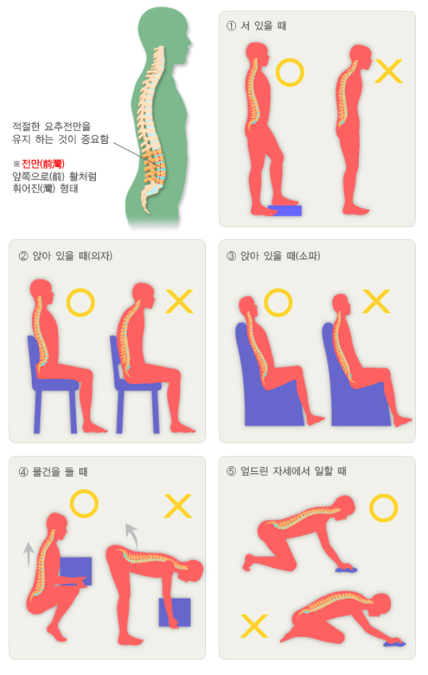 허리 삐끗했을때