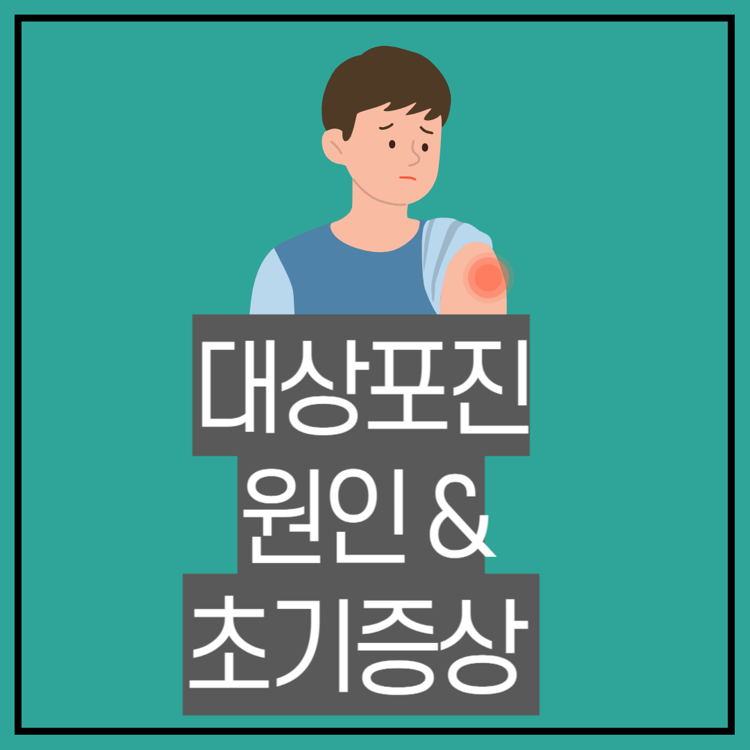 대상포진 증상과 원인