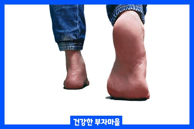 족저근막염 증상