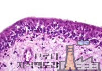 요도 간지러움