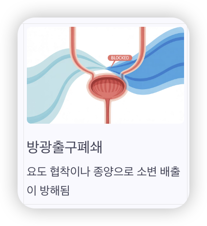 잔뇨감-지속되는-이유-방광출구폐쇄