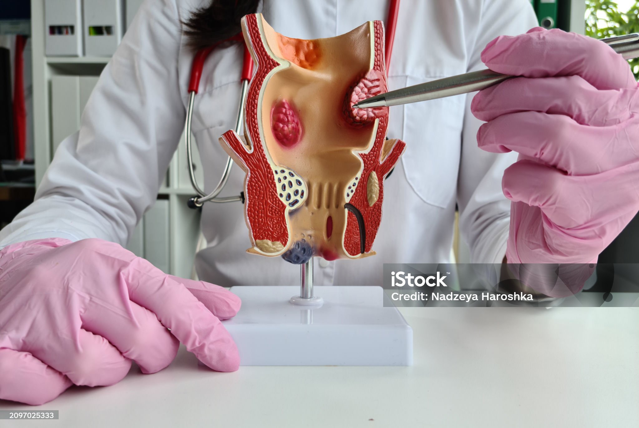 요도암-관련-사진