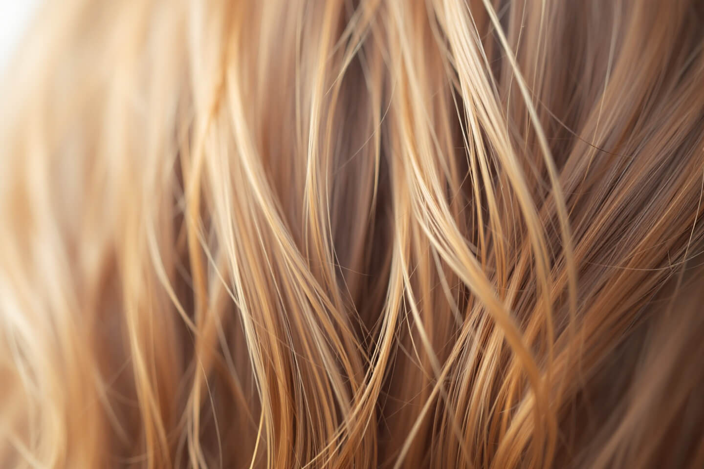 아연과 관련된 사진입니다.