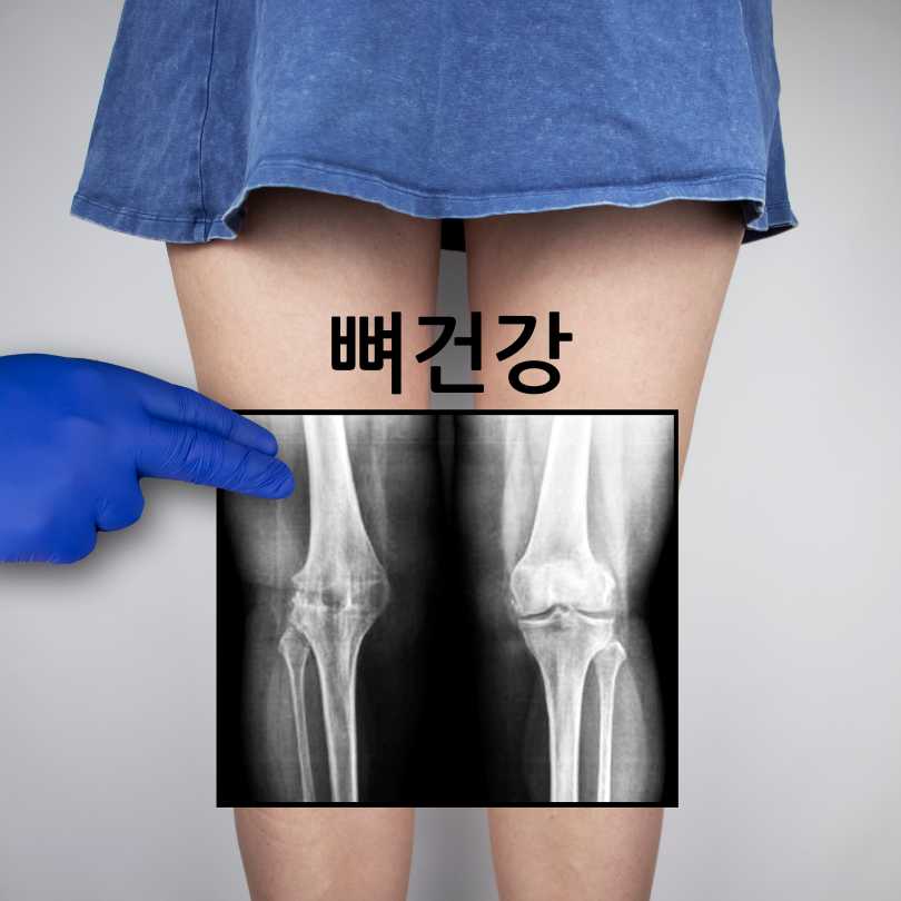 먹는 콜라겐 효능