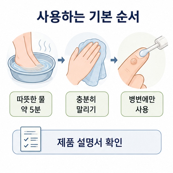 사마귀를 따뜻한 물에 약 5분 담근 뒤 말리고 병변에만 약을 사용하는 기본 순서를 정리한 이미지