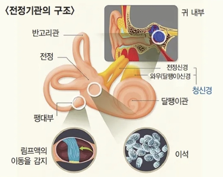 겨울철 빙글빙글 이석증 귀 돌멩이 어지럼증 구토 두통 메스꺼움