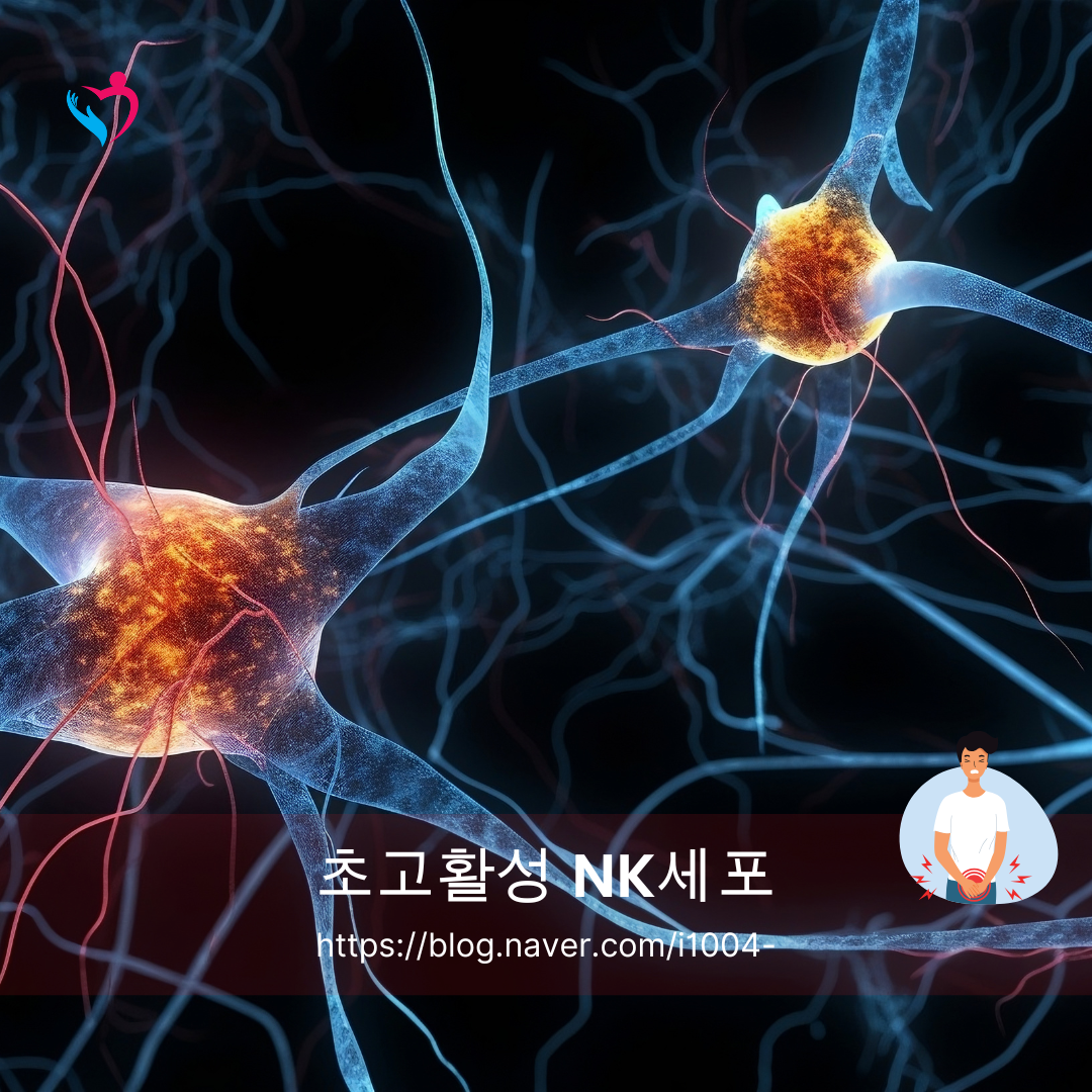 NK세포 암 예방 일본 치료에 대하여