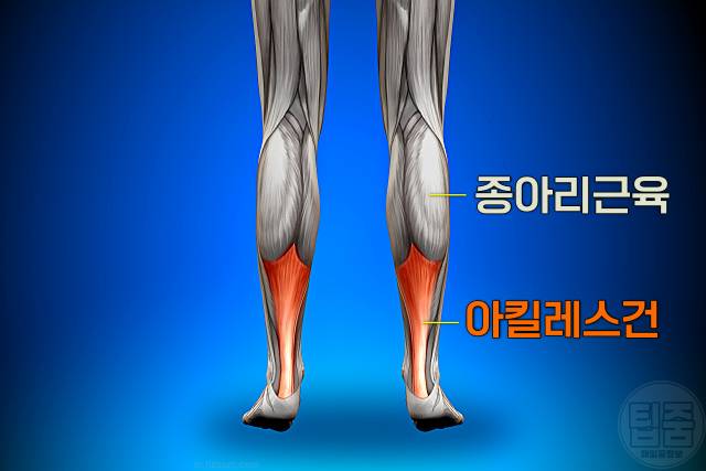 종아리 통증 원인 종아리가 땡기고 아파요 아킬레스건염