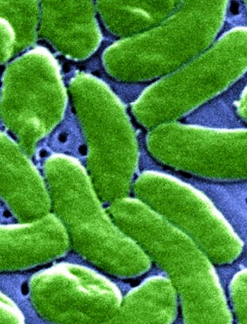 비브리오 패혈증 증상 18가지