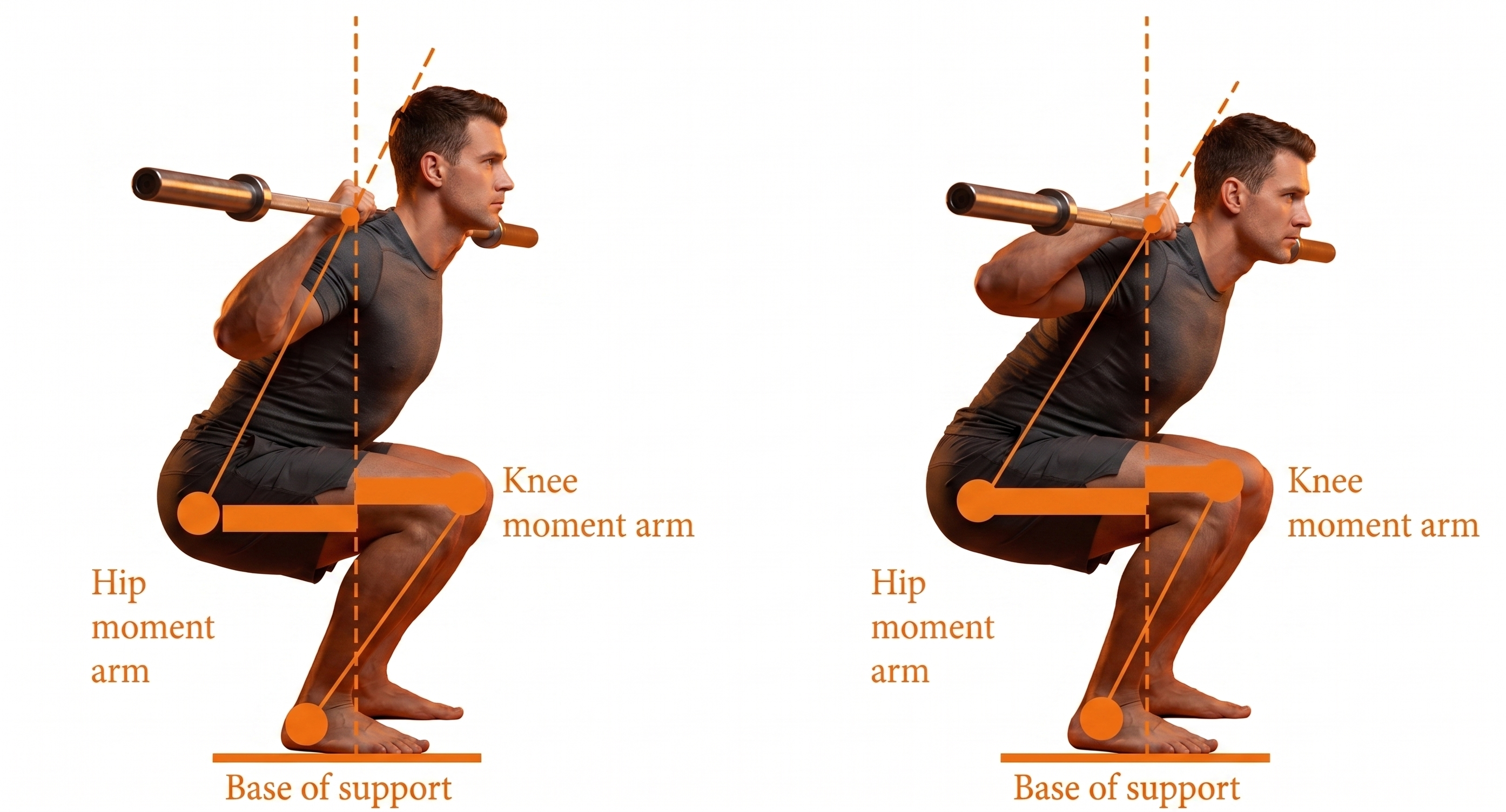 허리 과부하 구조와 하중 분산 구조