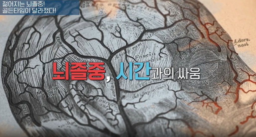 젊어지는-뇌졸중-골든타임이달라졌다