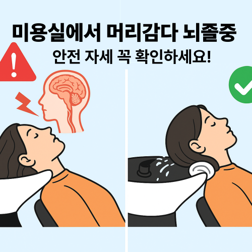 “미용실 뇌졸중 증후군 예방 – 샴푸대에서 목을 젖히지 않고 수건을 받쳐 안전하게 머리 감는 법”