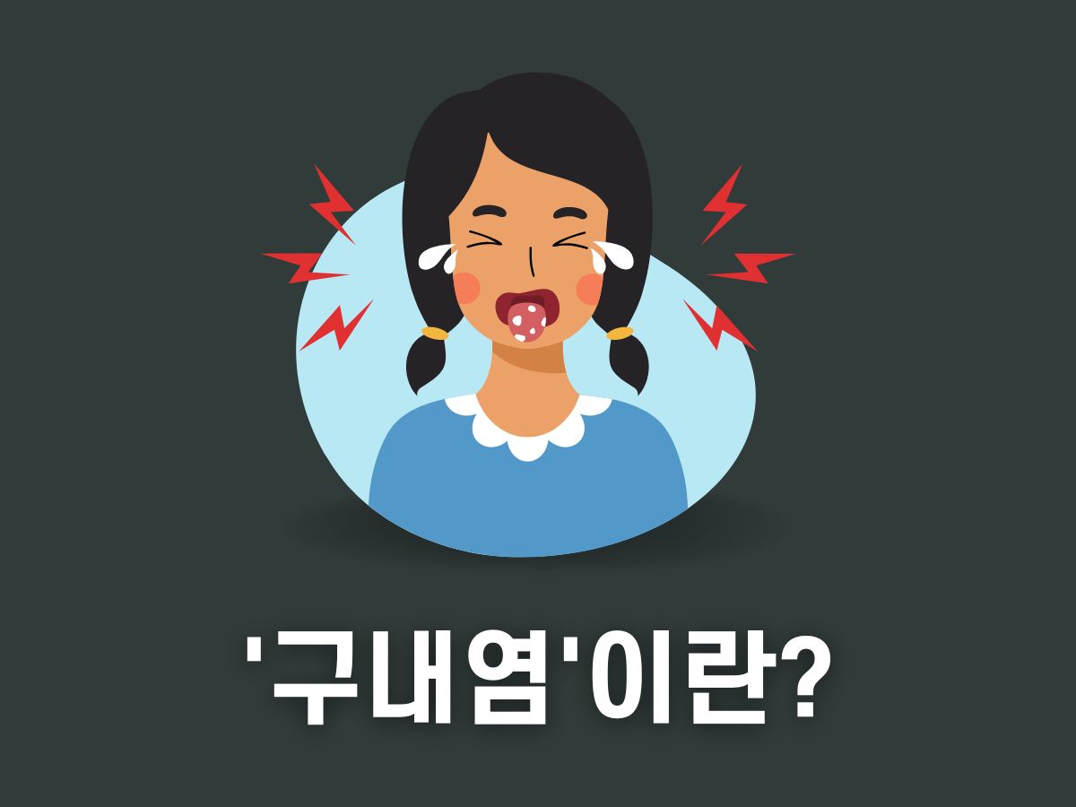 구내염