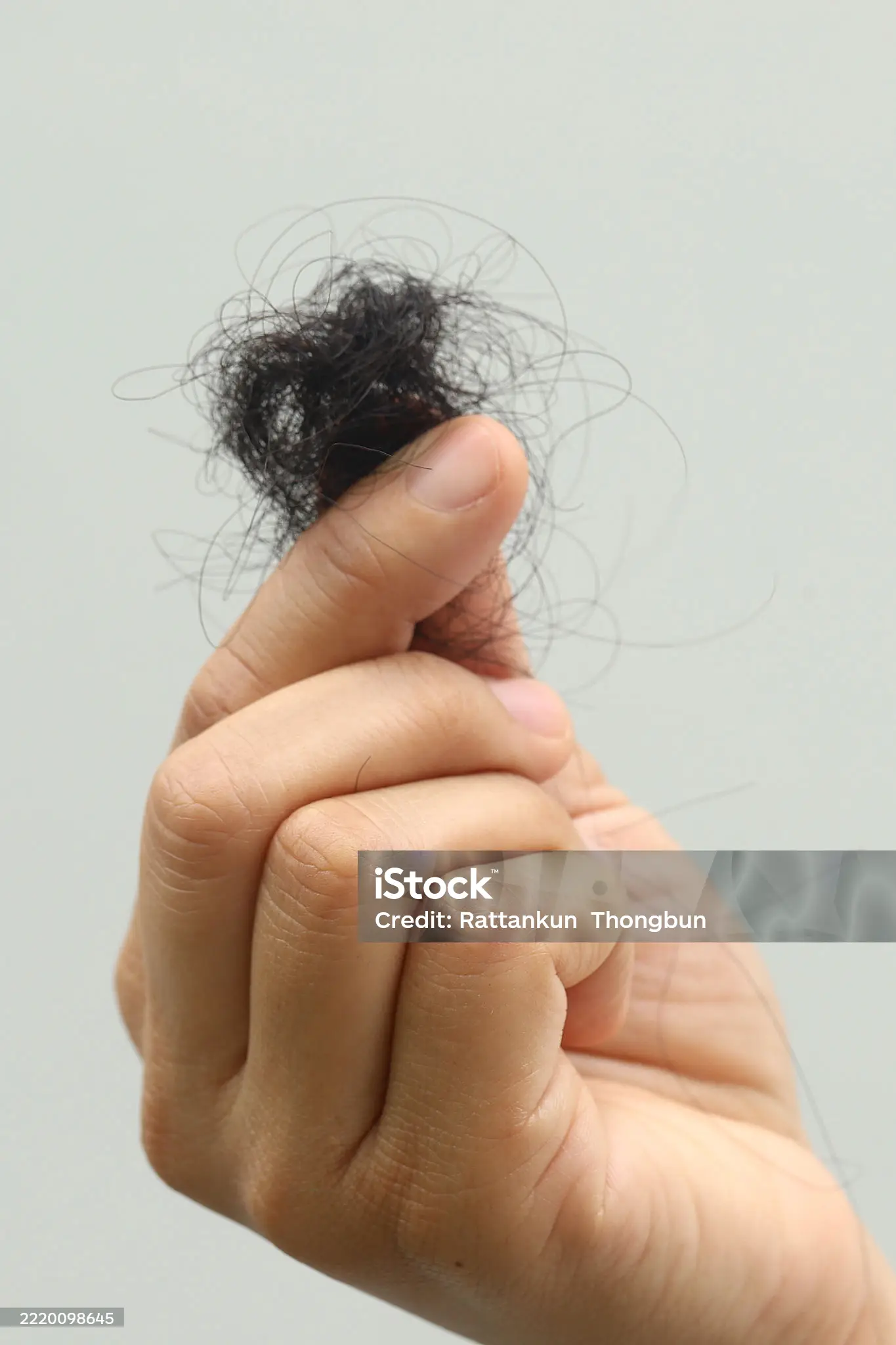 탈모 초기 증상 자가진단