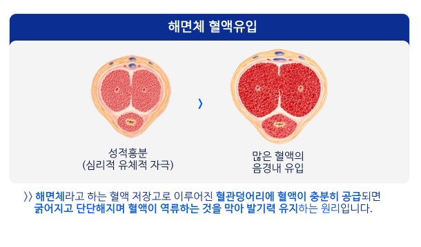 조이텍 사용 후기