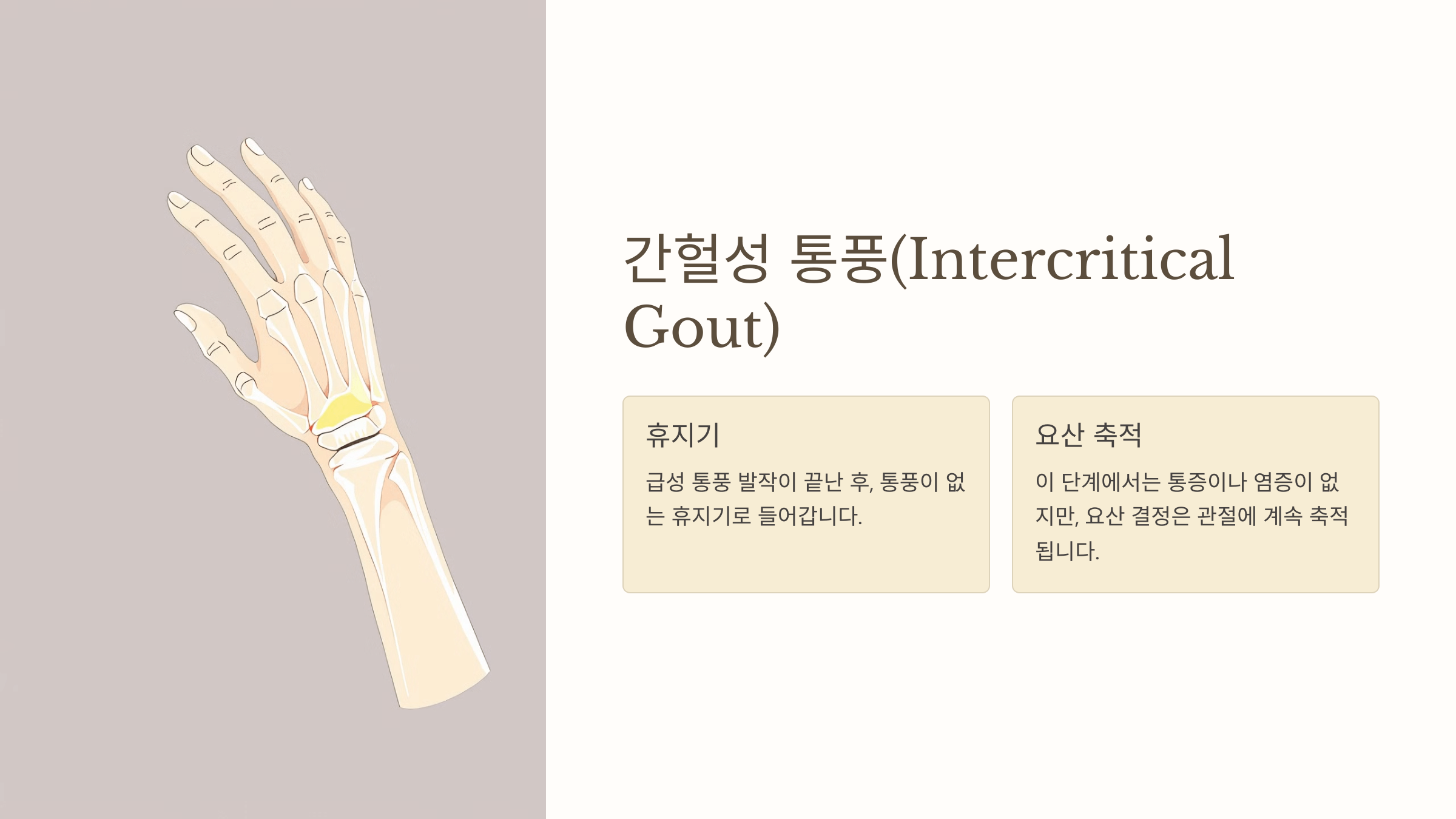 통풍과 관련된 사진입니다.