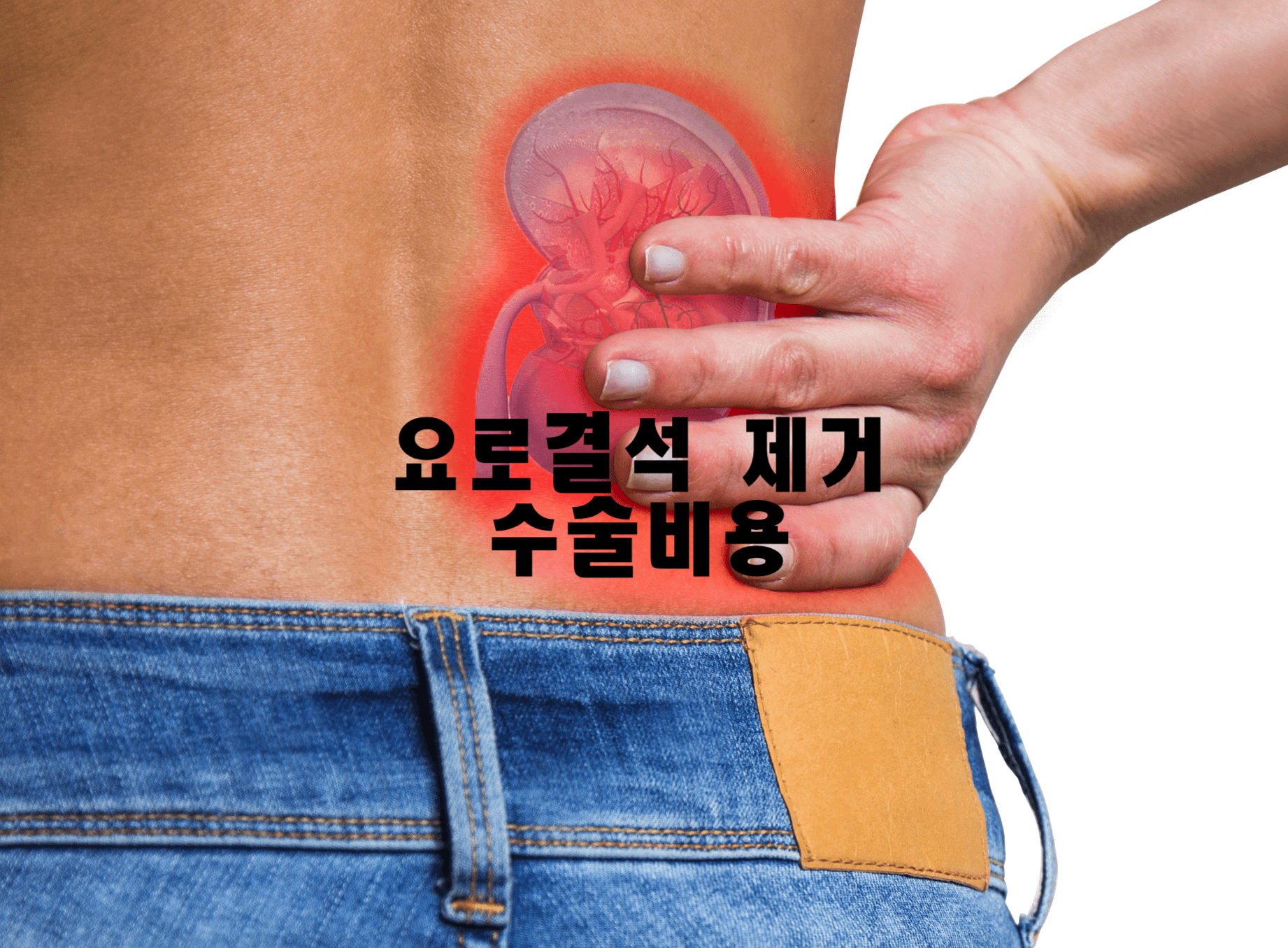 요로결석 제거