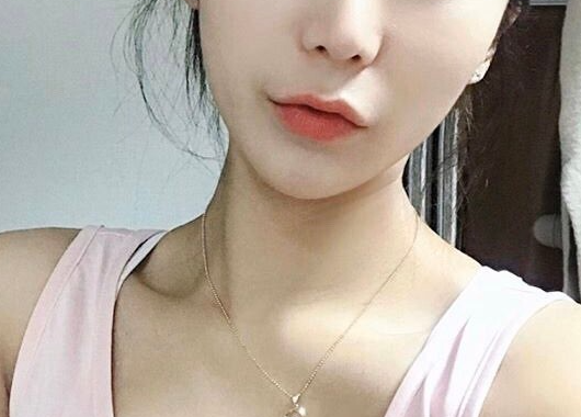 인중 축소 수술 후기