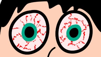 눈 실핏줄 터짐&amp;#44; 단순 피로일까?