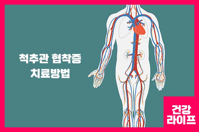 치료방법 - 물리, 약물, 도수, 한방, 추나