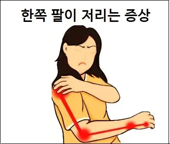 한쪽 팔이 저리는 증상