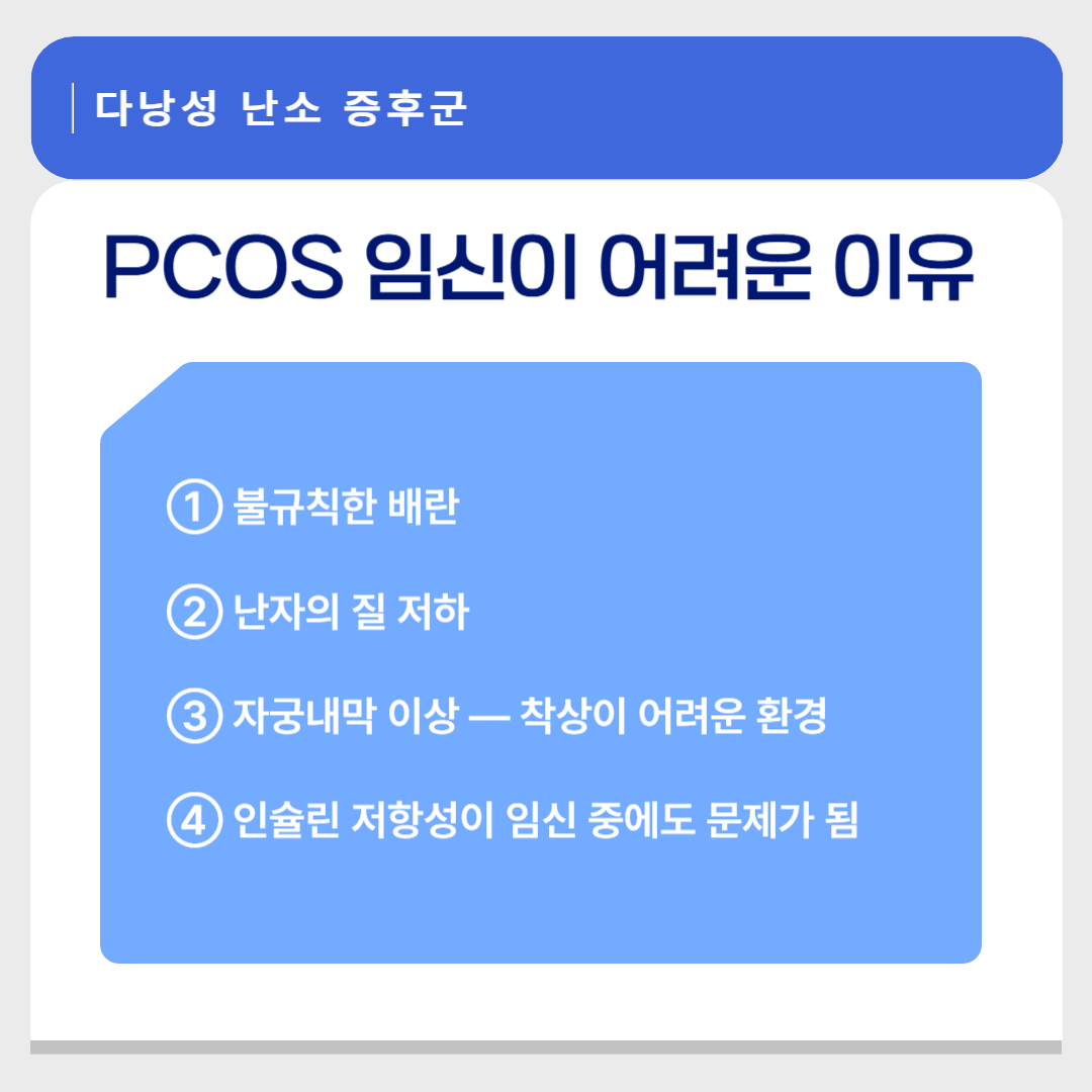 다낭성 난소 증후군