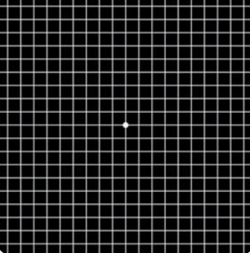 황반변성 증상 치료법 자가진단 원인 