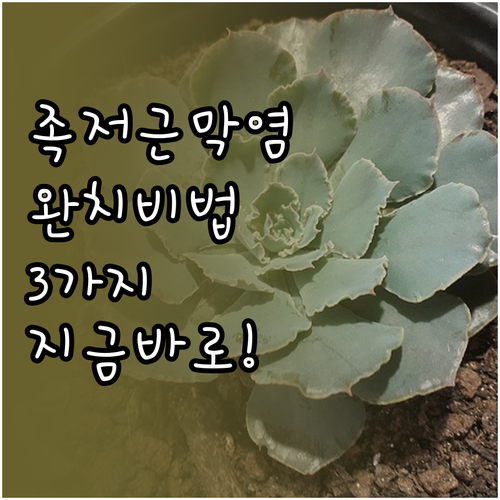 족저근막염 완치를 위한 치료 운동 관..